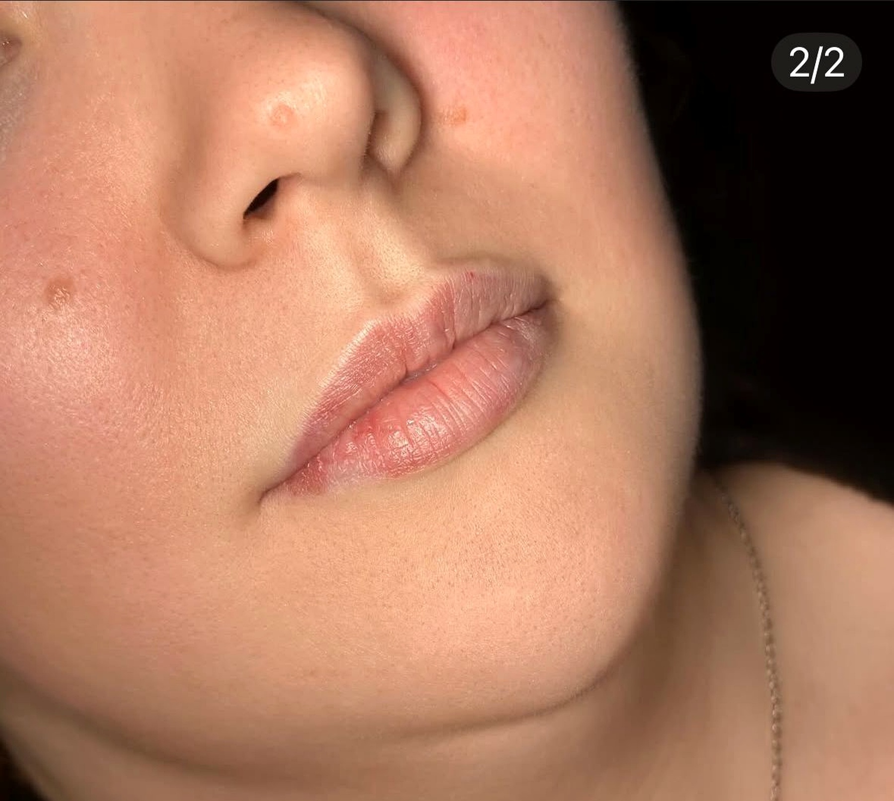 Russische Lippen before result